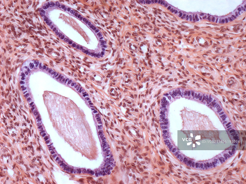 宫颈细胞显微照片图片素材