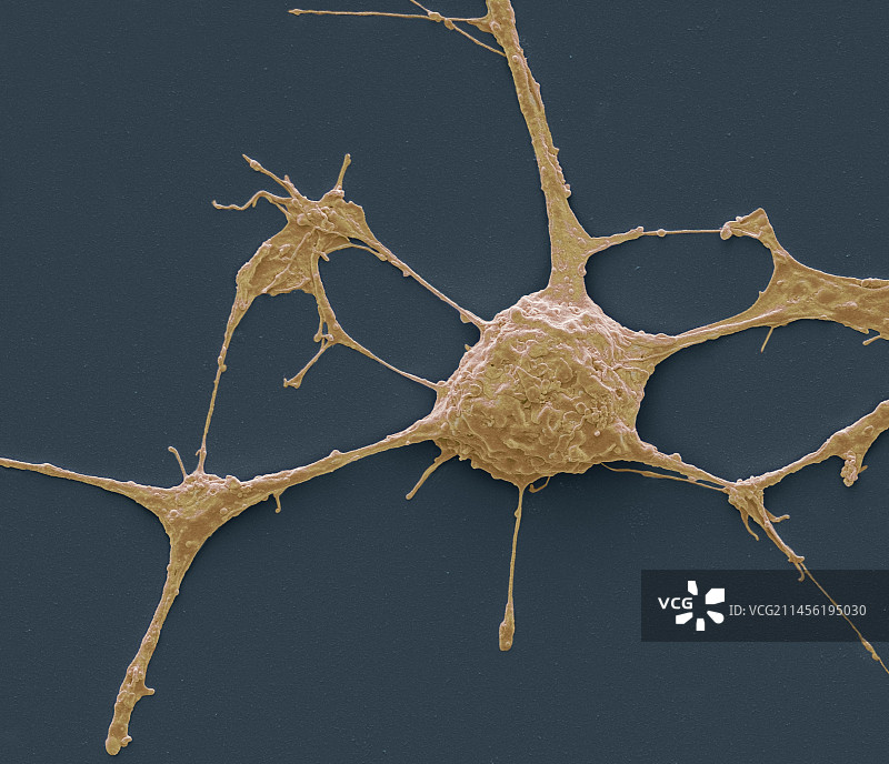 神经元扫描电镜图图片素材