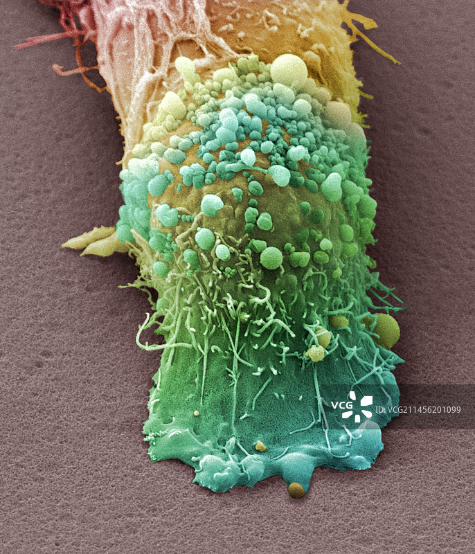 皮肤癌细胞，扫描电子显微镜图片素材