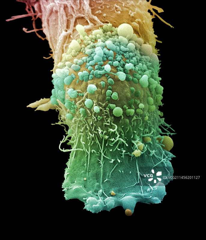 皮肤癌细胞，扫描电子显微镜图片素材