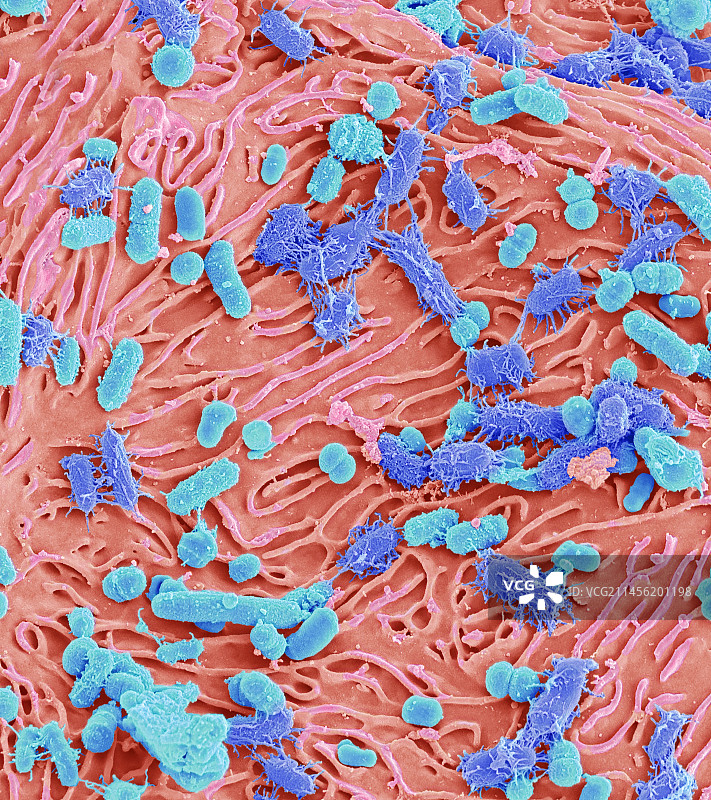 口腔细菌，扫描电镜图片素材