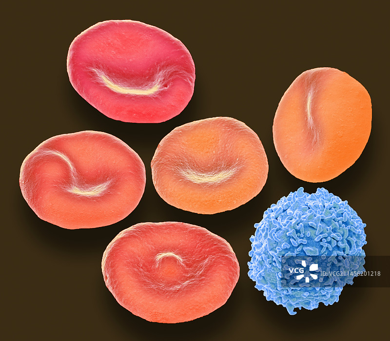 血细胞扫描电镜图图片素材