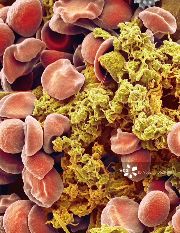 红细胞和血小板扫描电镜图图片素材