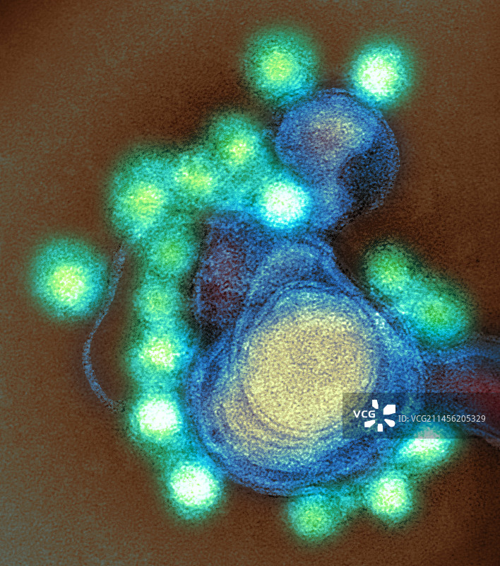 寨卡病毒颗粒TEM图片素材