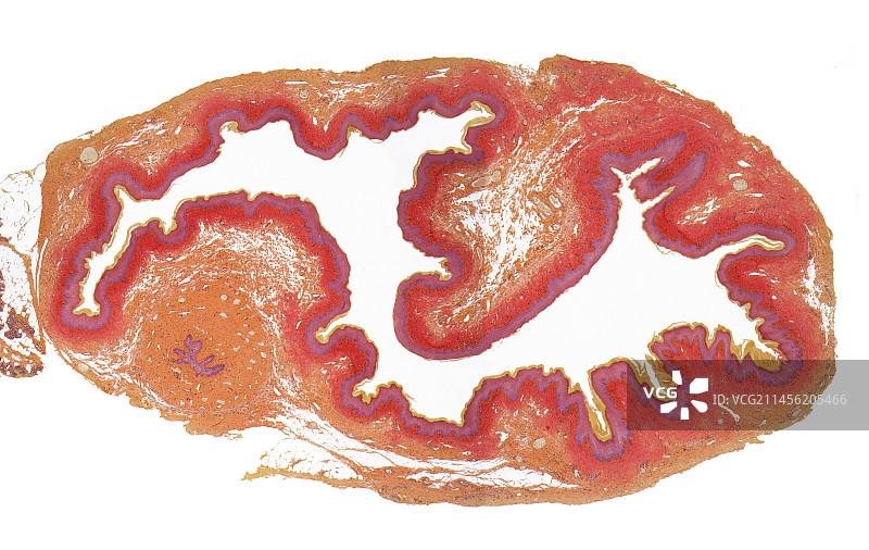 子宫颈显微镜图图片素材
