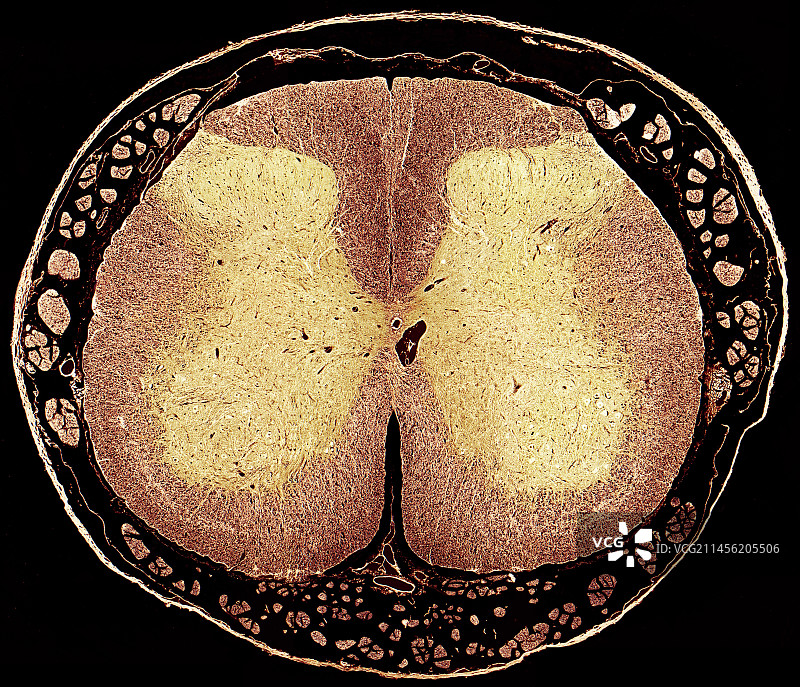 脊髓，LM图片素材