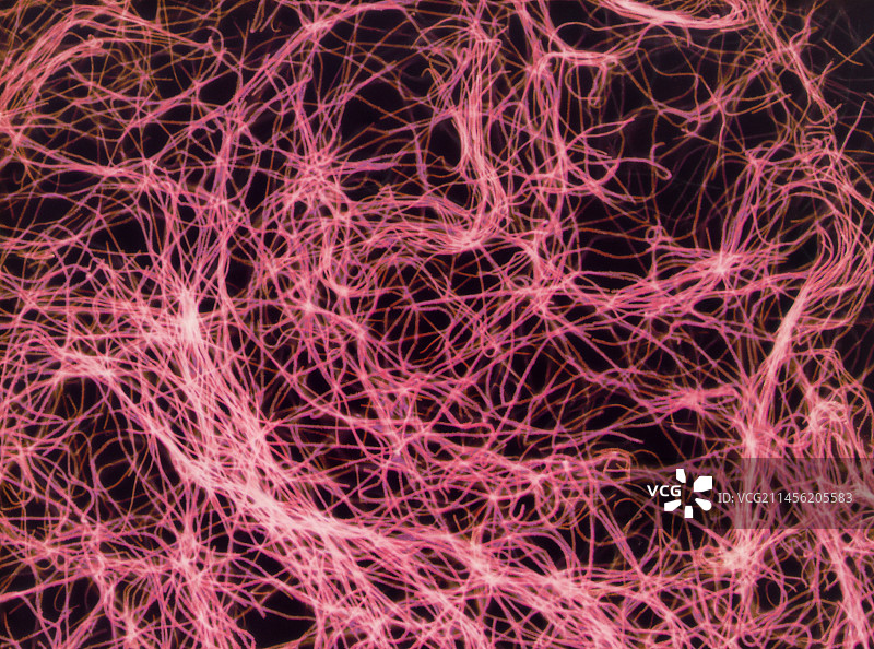 炭疽杆菌，LM图片素材