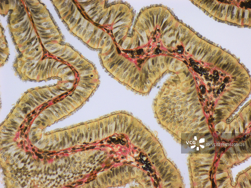 输卵管，LM图片素材