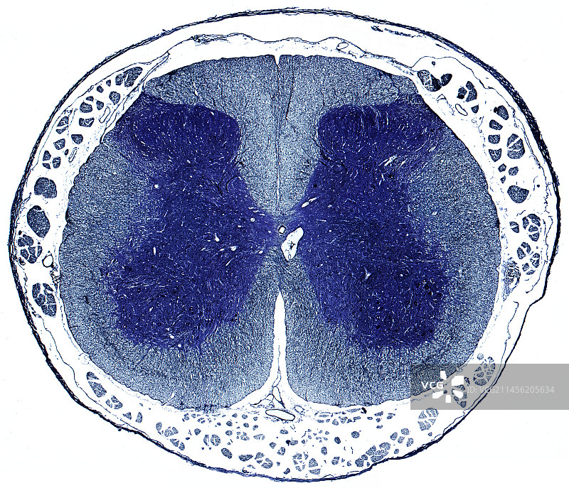 脊髓，LM图片素材