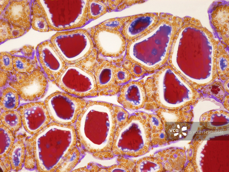 甲状腺，LM图片素材