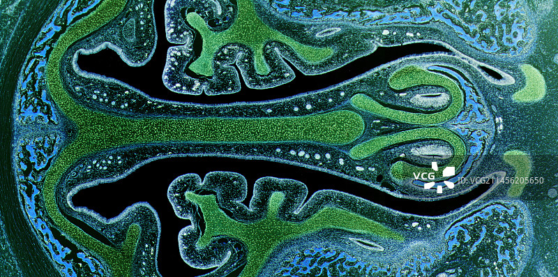 鼻窦，LM图片素材