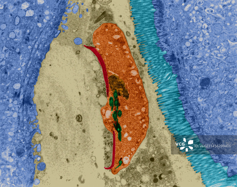 原生动物肠道感染（贾第鞭毛虫属），TEM图片素材