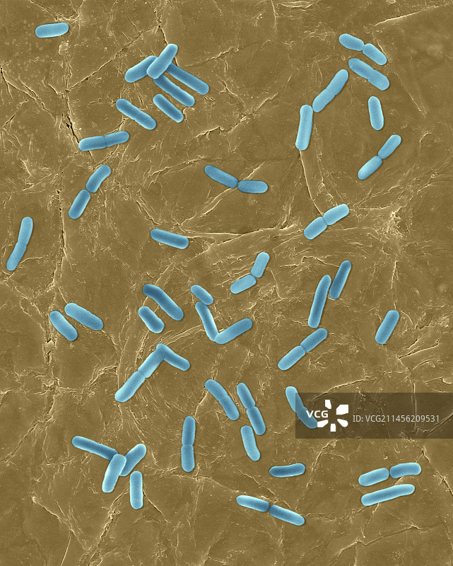 人皮肤表面上的大肠杆菌，扫描电镜照片图片素材