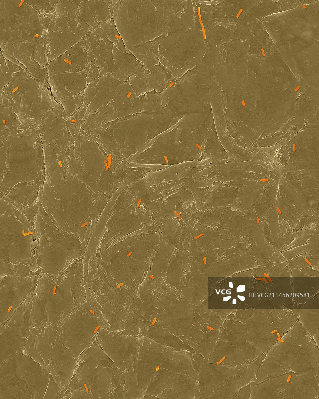 人皮肤表面上的大肠杆菌，扫描电镜照片图片素材