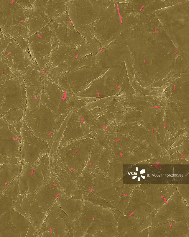 人皮肤表面上的大肠杆菌，扫描电镜照片图片素材