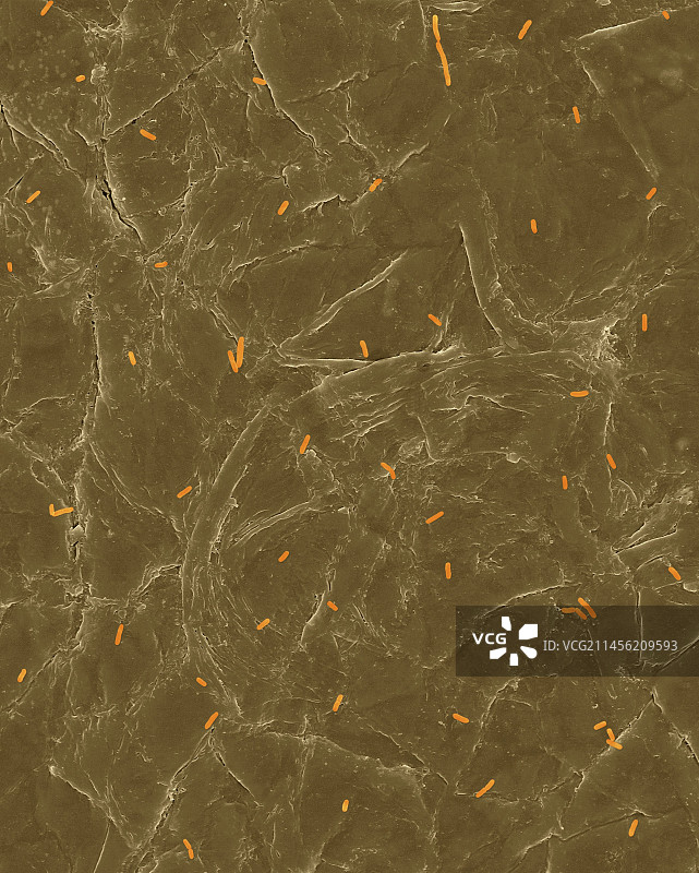 人皮肤表面上的大肠杆菌，扫描电镜照片图片素材