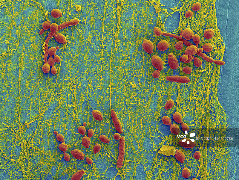 感染念珠菌的医用导管扫描电镜图图片素材