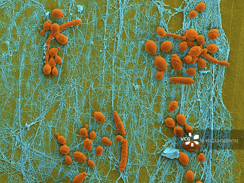 感染念珠菌的医用导管扫描电镜图图片素材