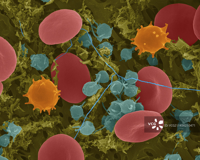 红细胞、单核细胞、血小板和纤维蛋白扫描电镜图图片素材