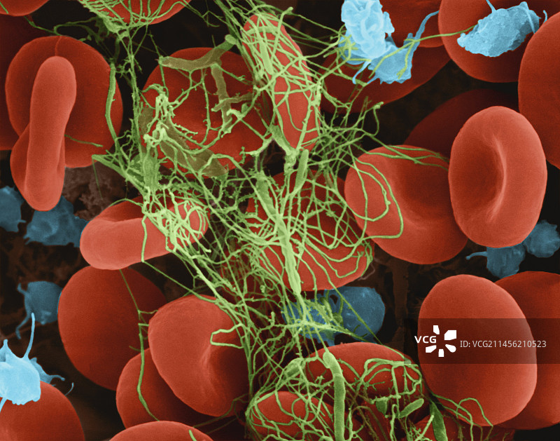 血纤维蛋白凝块中捕获的红细胞，扫描电镜图片素材