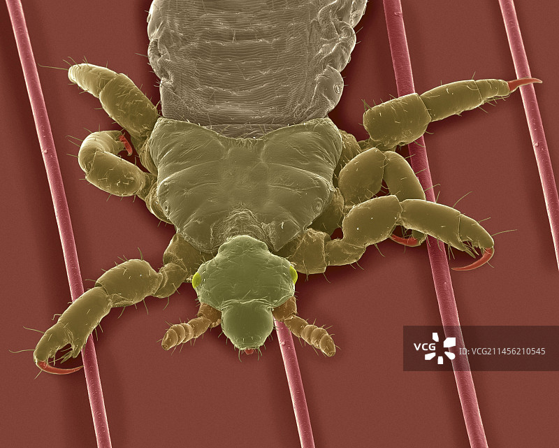 人发上的头虱（扫描电镜图）图片素材