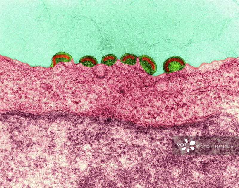 淋巴组织中的艾滋病毒感染，透射电镜图片素材