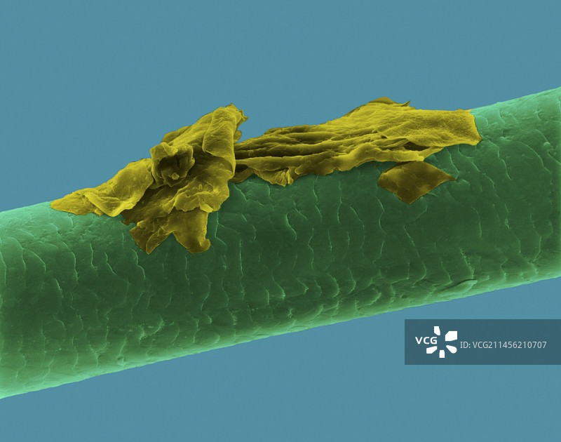 带头皮屑的人类头发扫描电镜图图片素材
