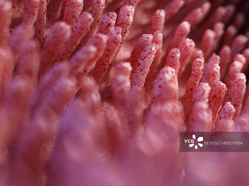 发炎的肠绒毛插画图片素材