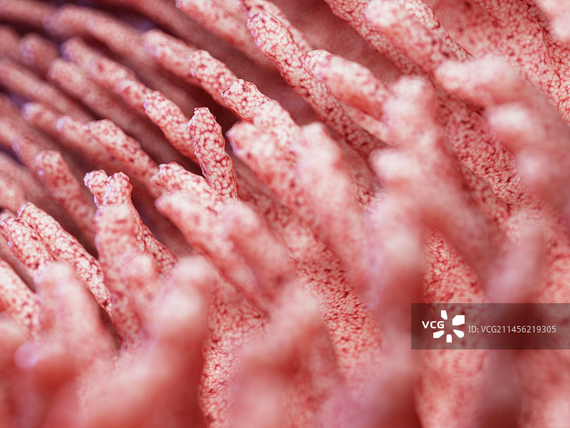 发炎的肠绒毛插画图片素材