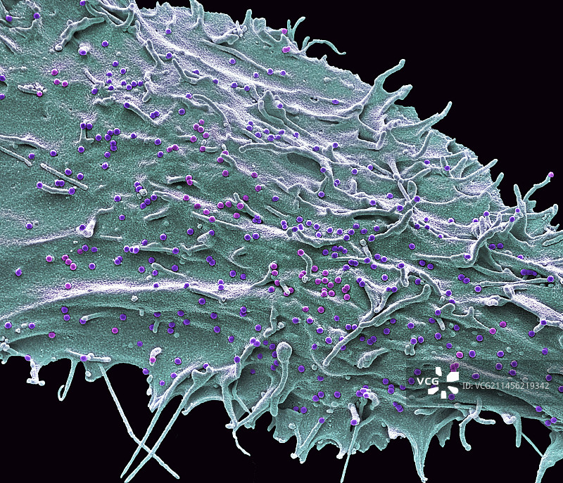 SIV感染细胞扫描电镜图图片素材