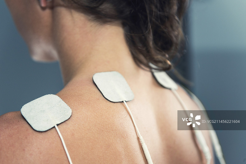 经皮神经电刺激疗法图片素材