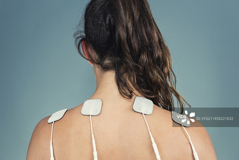 经皮神经电刺激疗法图片素材