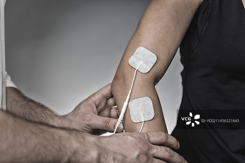 手臂上放置TENS电极图片素材