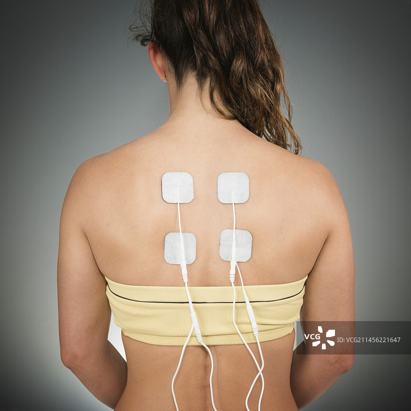 经皮神经电刺激疗法图片素材