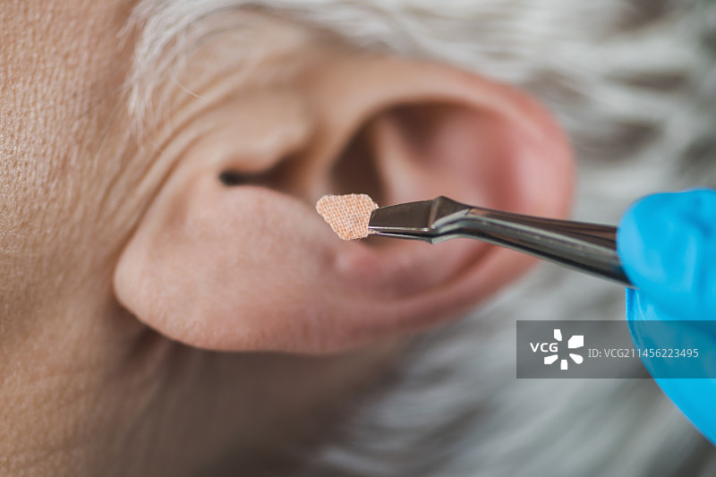 耳穴疗法图片素材