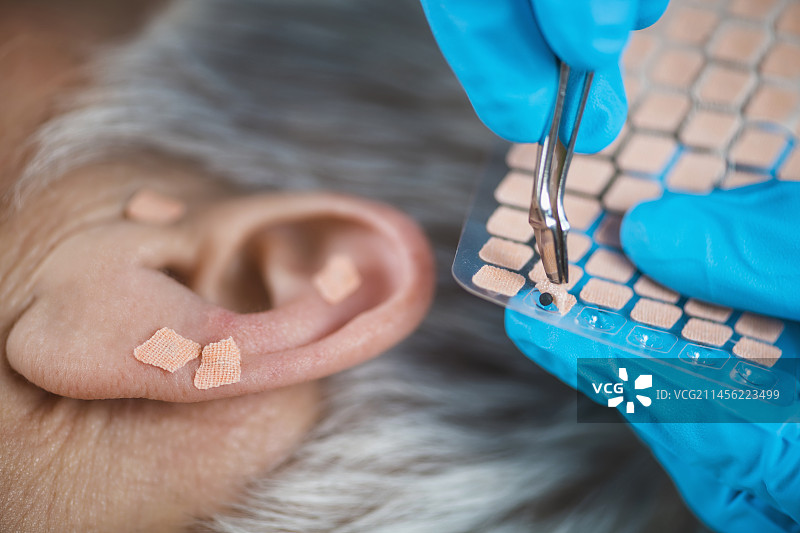 耳穴疗法图片素材