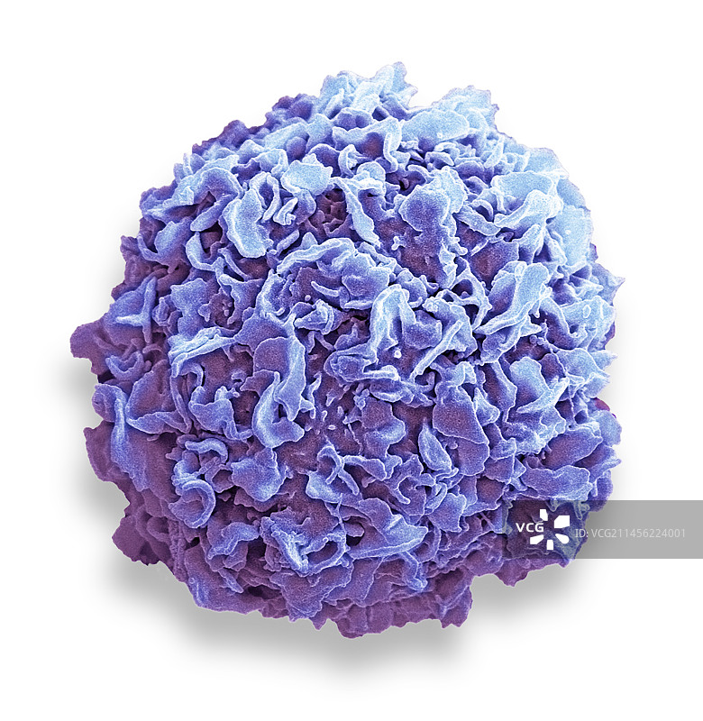 乳腺癌细胞扫描电镜图图片素材