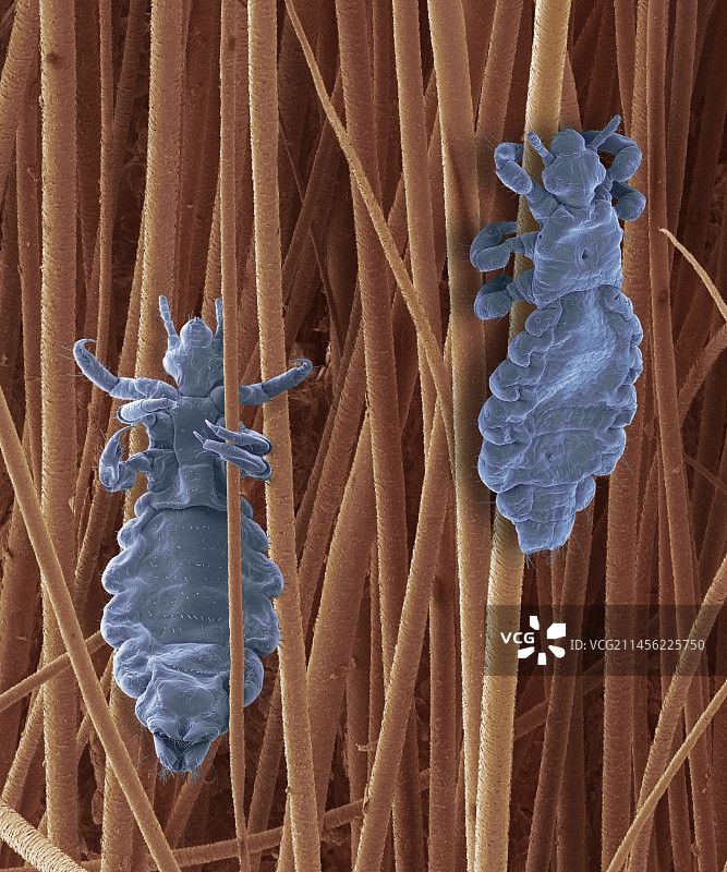 头虱扫描电镜图图片素材