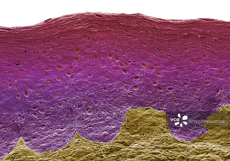 阴道，扫描电镜图片素材
