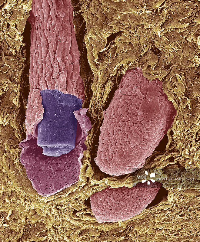 毛囊，扫描电镜图片素材