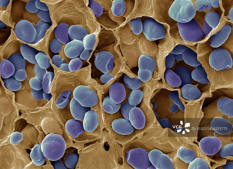 淀粉颗粒，扫描电镜图片素材