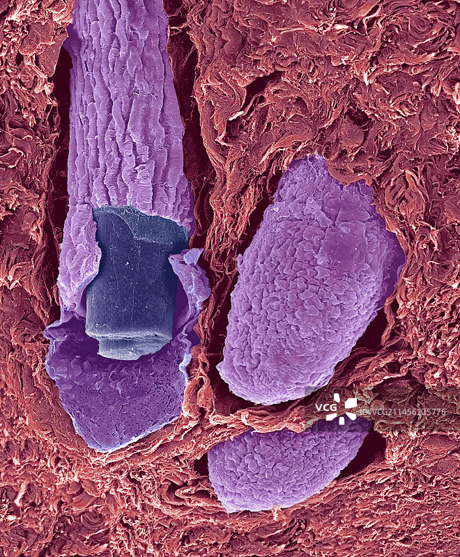 毛囊，扫描电镜图片素材