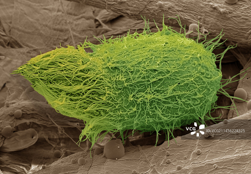 栉发草履虫纤毛原生动物，扫描电镜图片素材