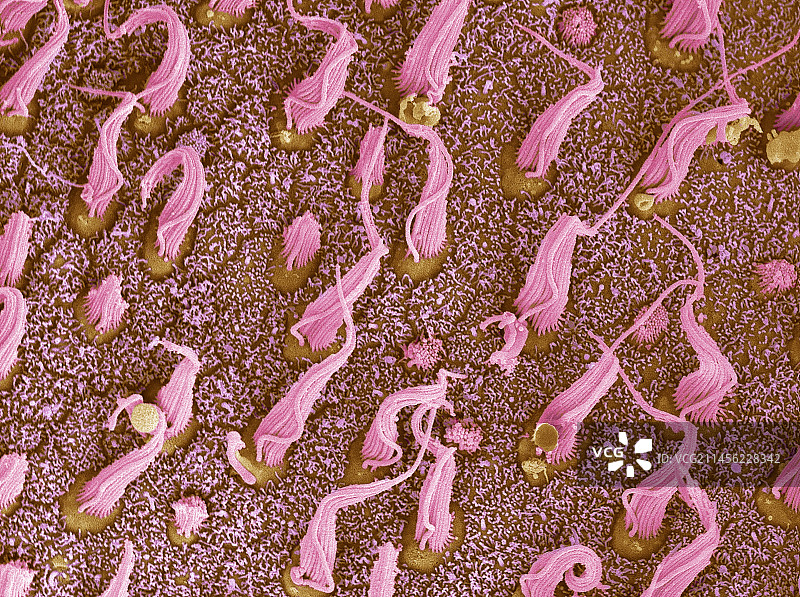 内耳感觉细胞扫描电镜图图片素材