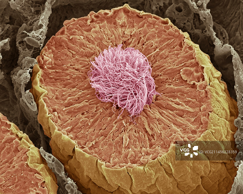 睾丸曲细精管扫描电镜照片图片素材