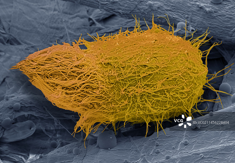 栉发草履虫纤毛原生动物，扫描电镜图片素材