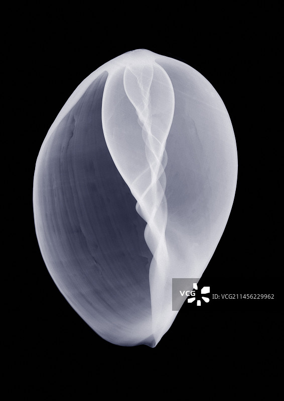 印度涡螺壳X光片图片素材