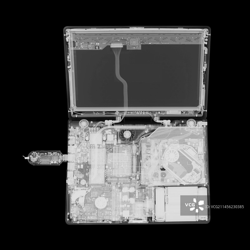 电脑X光片图片素材