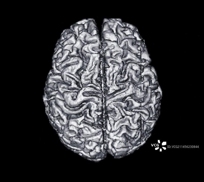 大脑俯视图X光片图片素材