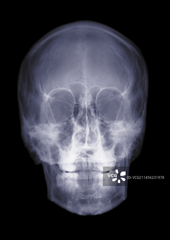 人类头骨X光片图片素材